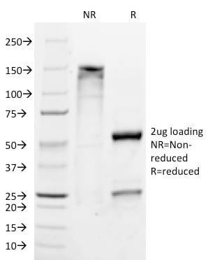 ETS1 Monoclonal Mouse Antibody (ETS1/1282)