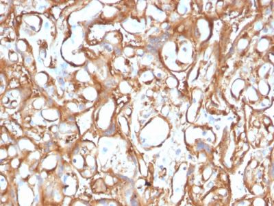 Ezrin / p81 Monoclonal Mouse Antibody (CPTC-Ezrin-1)