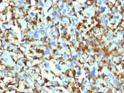 Factor XIIIa Monoclonal Mouse Antibody (F13A1/1448)
