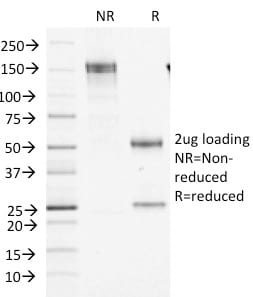Factor XIIIa Monoclonal Mouse Antibody (F13A1/1448)