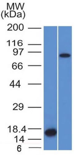Factor XIIIa Monoclonal Mouse Antibody (F13A1/1448)