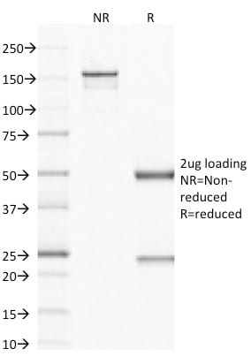 Factor XIIIa Monoclonal Mouse Antibody (F13A1/1683)