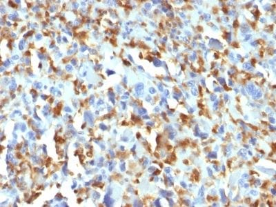 Factor XIIIa Monoclonal Mouse Antibody (F13A1/1683)