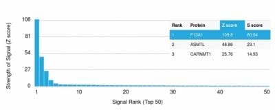 Factor XIIIa Monoclonal Mouse Antibody (F13A1/1683)