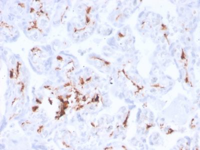 Factor XIIIa Recombinant Monoclonal Rabbit Antibody (F13A1/3772R)