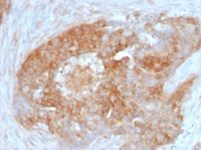 Fascin-1 Monoclonal Mouse Antibody (FSCN1/417)