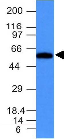 Fascin-1 Monoclonal Mouse Antibody (FSCN1/417)