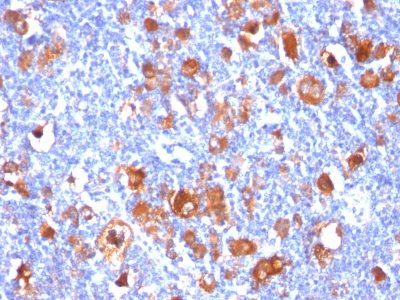 Fascin-1 Monoclonal Mouse Antibody (FSCN1/418)