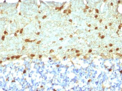 Fascin-1 Monoclonal Mouse Antibody (FSCN1/418)