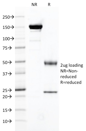 FOLH1 / PSMA Monoclonal Mouse Antibody (FOLH1/2121)