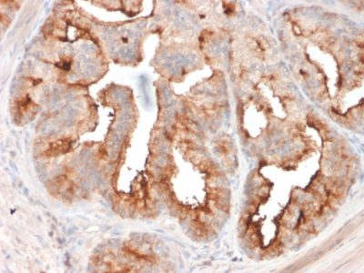 FOLH1 / PSMA Monoclonal Mouse Antibody (FOLH1/2354)