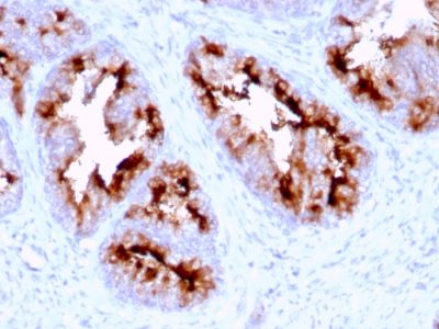FOLH1 / PSMA Monoclonal Mouse Antibody (FOLH1/2363)