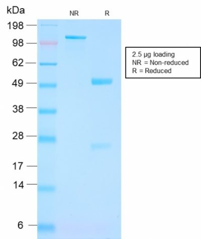 FOLH1 / PSMA Recombinant Monoclonal Rabbit Antibody (FOLH1/3149R)