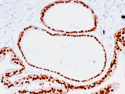 FOXA1 / HNF3A Monoclonal Mouse Antibody (FOXA1/1516)