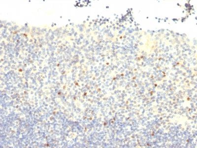 FOXP3 Monoclonal Mouse Antibody (FXP3/197)