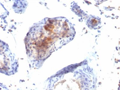 FOXP3 Monoclonal Mouse Antibody (FXP3/197)