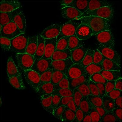 Gamma Catenin Recombinant Monoclonal Mouse Antibody (rCTNG/1664)