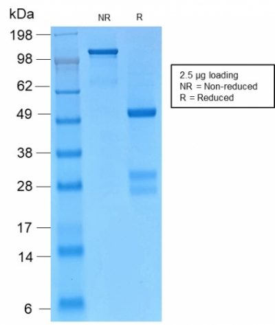 Gamma Catenin Recombinant Monoclonal Rabbit Antibody (CTNG/2155R)