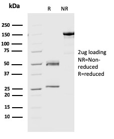 Geminin / DNA Replication Inhibitor Monoclonal Mouse Antibody (CPTC-GMMN-1)