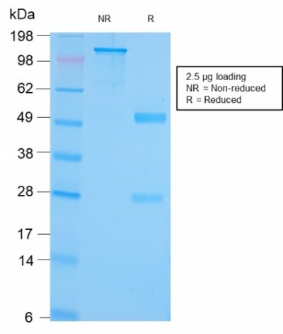 Glucose-Regulated Protein 94 Recombinant Monoclonal Rabbit Antibody (HSP90B1/3168R)