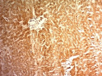 Glypican-3 Monoclonal Mouse Antibody (1G12)