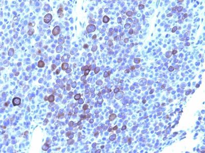Glypican-3 Monoclonal Mouse Antibody (GPC3/863 + 1G12)
