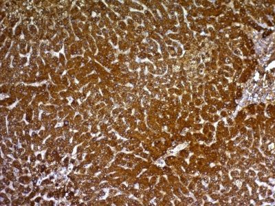 Glypican-3 Monoclonal Mouse Antibody (GPC3/863)