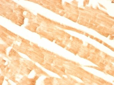 Glypican-3 Monoclonal Mouse Antibody (GPC3/863)