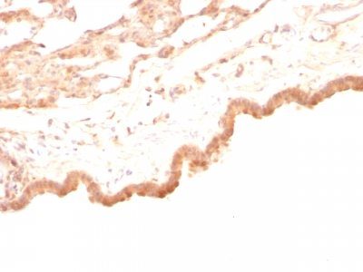 Glypican-3 Monoclonal Mouse Antibody (GPC3/863)