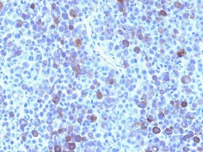 Glypican-3 Monoclonal Mouse Antibody (GPC3/863)