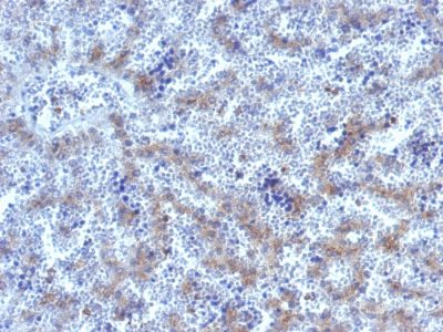Glypican-3 Polyclonal Rabbit Antibody