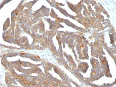 GnRH Receptor Monoclonal Mouse Antibody (F1G4)