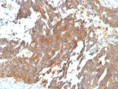 GnRH Receptor Monoclonal Mouse Antibody (GNRHR/768)