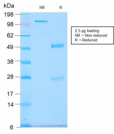 GnRH-Receptor / LH-RH Receptor Recombinant Monoclonal Rabbit Antibody (GNRHR/2982R)