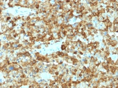 gp100 / Melanosome / PMEL17 / SILV Monoclonal Mouse Antibody (PMEL/2037)