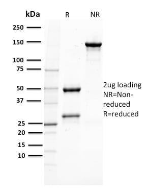 gp100 / Melanosome / PMEL17 / SILV Monoclonal Mouse Antibody (PMEL/2037)