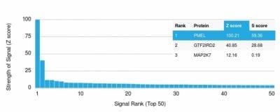 gp100 / Melanosome / PMEL17 / SILV Monoclonal Mouse Antibody (PMEL/2037)