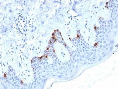 gp100 / Melanosome / PMEL17 / SILV Monoclonal Mouse Antibody (PMEL/2038)