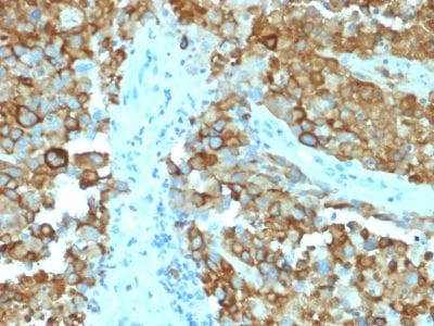 gp100 / Melanosome / PMEL17 / SILV Monoclonal Mouse Antibody (PMEL/2038)