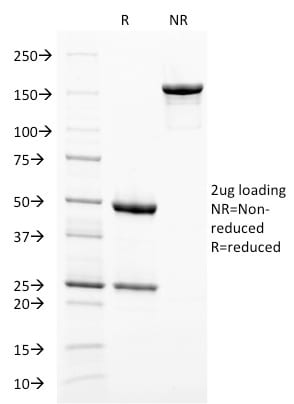 gp100 / Melanosome / PMEL17 / SILV Monoclonal Mouse Antibody (PMEL/2038)