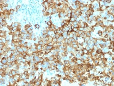 gp100 / Melanosome / PMEL17 / SILV Monoclonal Mouse Antibody (PMEL/2039)
