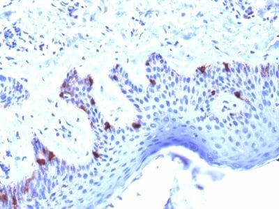 gp100 / Melanosome / PMEL17 / SILV Monoclonal Mouse Antibody (PMEL/2039)