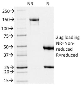 gp100 / Melanosome / PMEL17 / SILV Monoclonal Mouse Antibody (PMEL/2039)