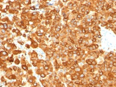 gp100 / Melanosome / PMEL17 / SILV Monoclonal Mouse Antibody (PMEL/783)