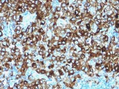 gp100 / Melanosome / PMEL17 / SILV Polyclonal Rabbit Antibody