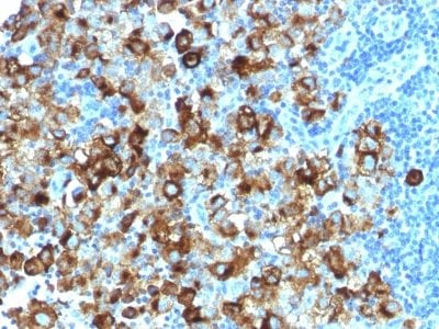 gp100 / Melanosome / PMEL17 / SILV Recombinant Monoclonal Rabbit Antibody (PMEL/1825R)