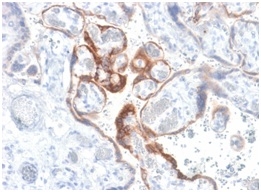 HCG Beta Recombinant Monoclonal Rabbit Antibody (HCGb/1985R)
