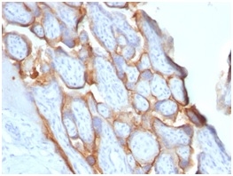 HCG Beta Recombinant Monoclonal Rabbit Antibody (HCGb/1996R)