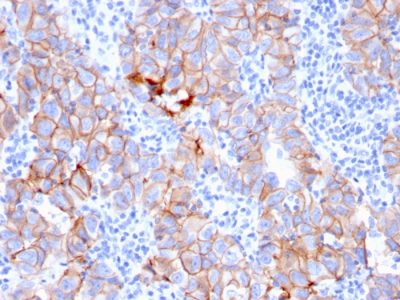 HER-2 / CD340 Monoclonal Mouse Antibody (ErbB2/3080)