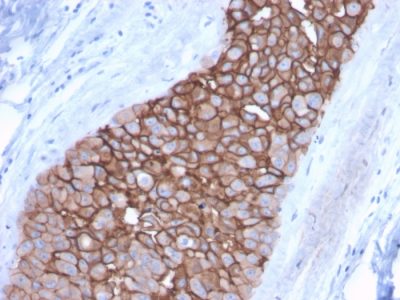 HER-2 / CD340 Monoclonal Mouse Antibody (ErbB2/3092)